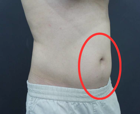 Before - 30代男性 3回