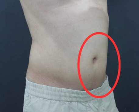 After - 30代男性 3回